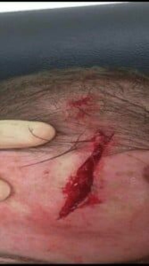 Nærbilde av skaden til Wayne Rooney. Bildet er hentet fra Rooneys offisielle Facebook-konto.