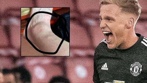 Auuu, Donny: – Velkommen til Premier League